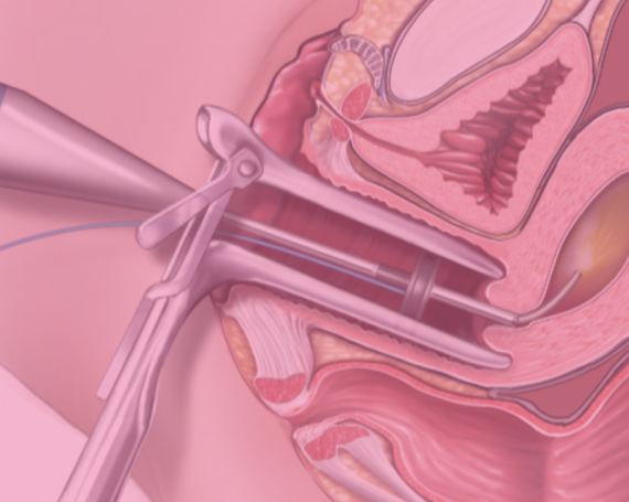Histeroscopia / Vaginoscopia